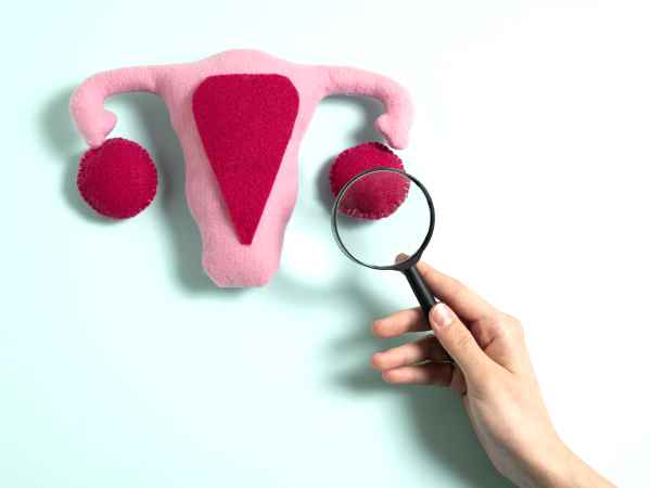 Endométriose et alimentation : les clés pour mieux gérer les symptômes