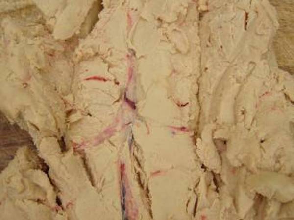 La terrine de foie gras mi-cuit aux 5 parfums, expliquée étape par étape - Préparation etape 3